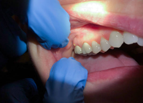 Best Emergency TMJ Treatment in Mesa, AZ