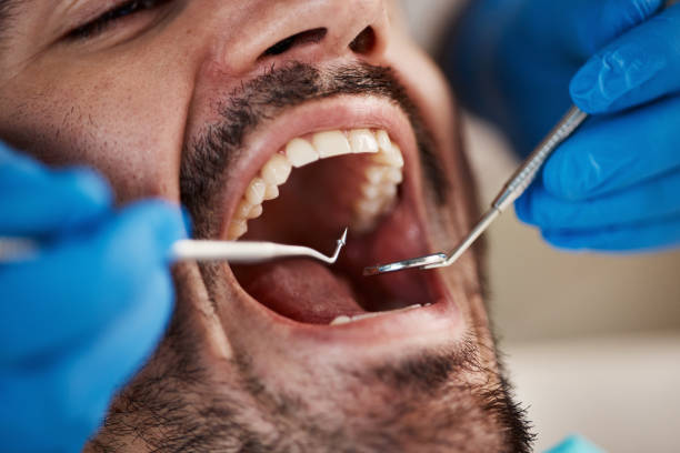 Best Urgent Care for Lost Fillings or Crowns in Mesa, AZ