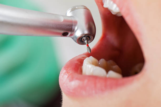 Best Emergency Dental Care for Broken or Chipped Teeth in Mesa, AZ